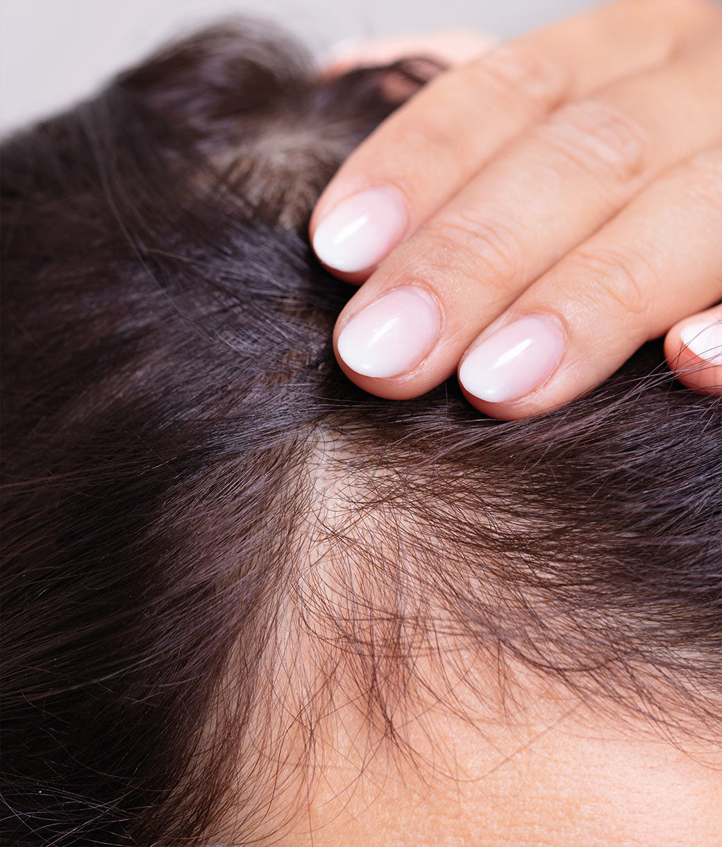 Contrarresta la caída del cabello QUERATINA COLOIDAL Suplemento Coloidal Puro - Nano Gotas BIOMED 750 ppm
