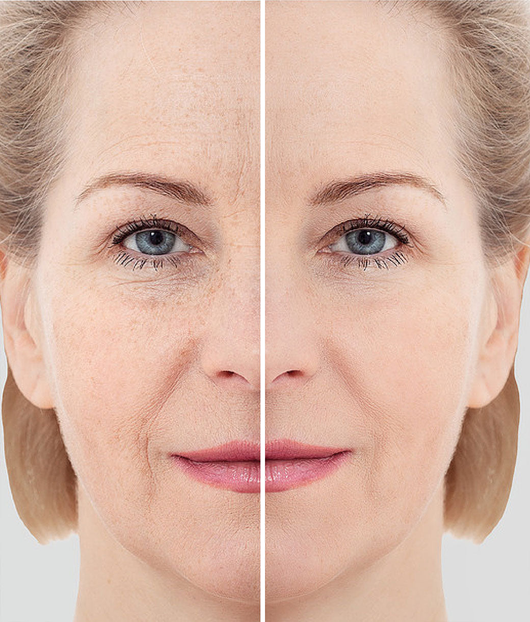 Contrarresta las ARRUGAS, protege, nutre e ilumina la piel VITAMINA A COLOIDAL - Suplemento Coloidal Puro - Nano Gotas BIOMED 1100 ppm