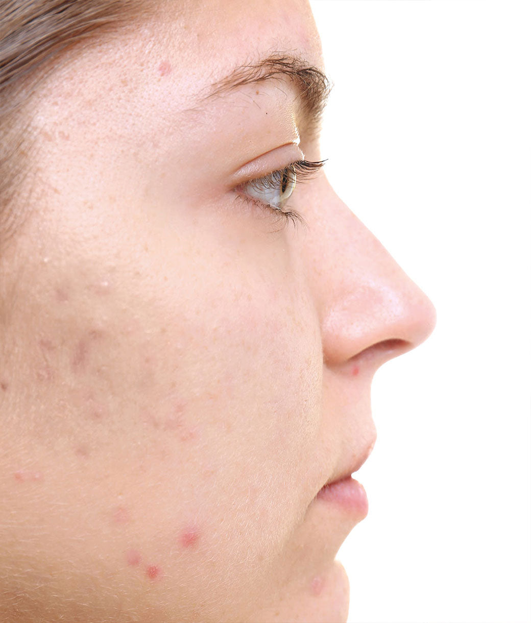 Prima - Penetra profundamente en la dermis, renovándola y mejorando su tono y calidad VITAMINA A COLOIDAL - Suplemento Coloidal Puro - Nano Gotas BIOMED 1100 ppm