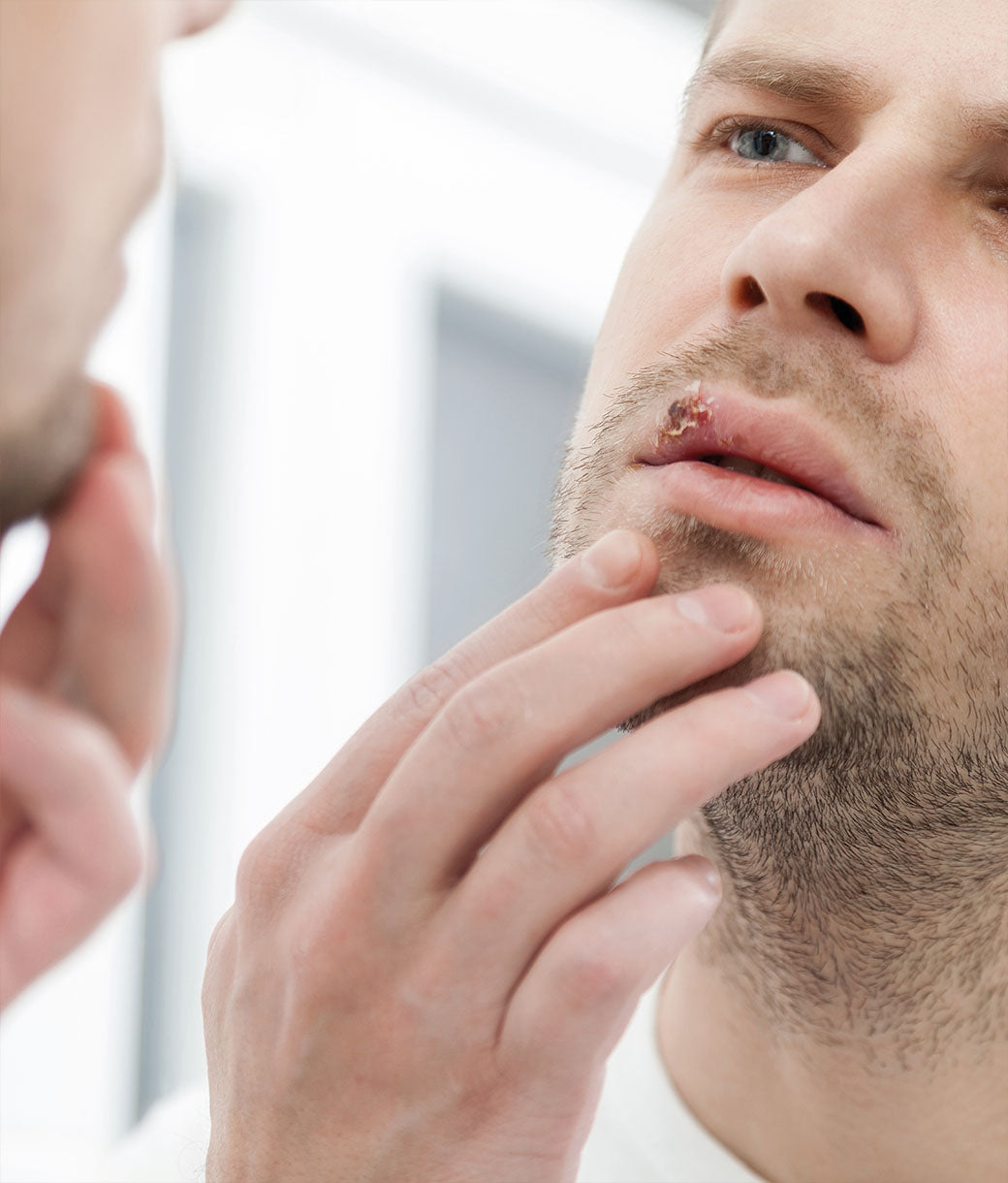 mejora de quemaduras, úlceras, dermatitis, previene herpes labial EQUINÁCEA COLOIDAL - Suplemento Coloidal Puro - Nano Gotas BIOMED 1000 ppm